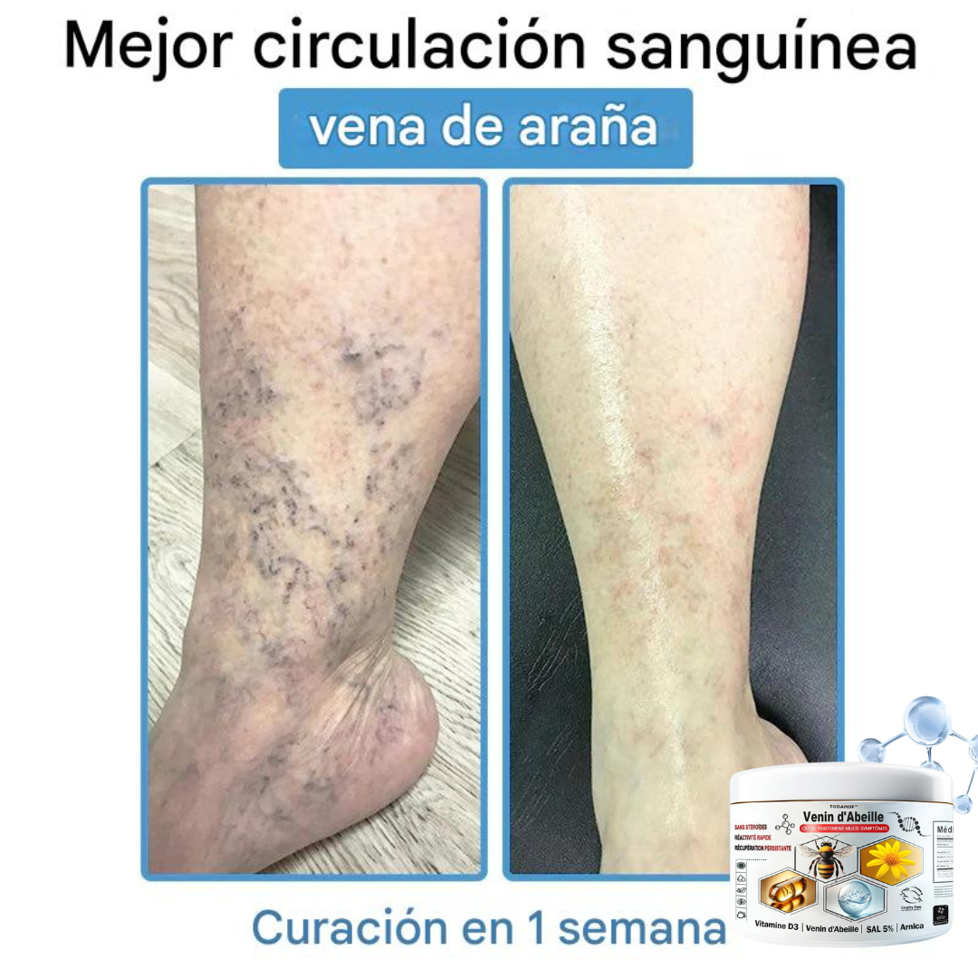 Crema antiinflamatoria multisíntomas con veneno de abeja (OFERTA 2X1)