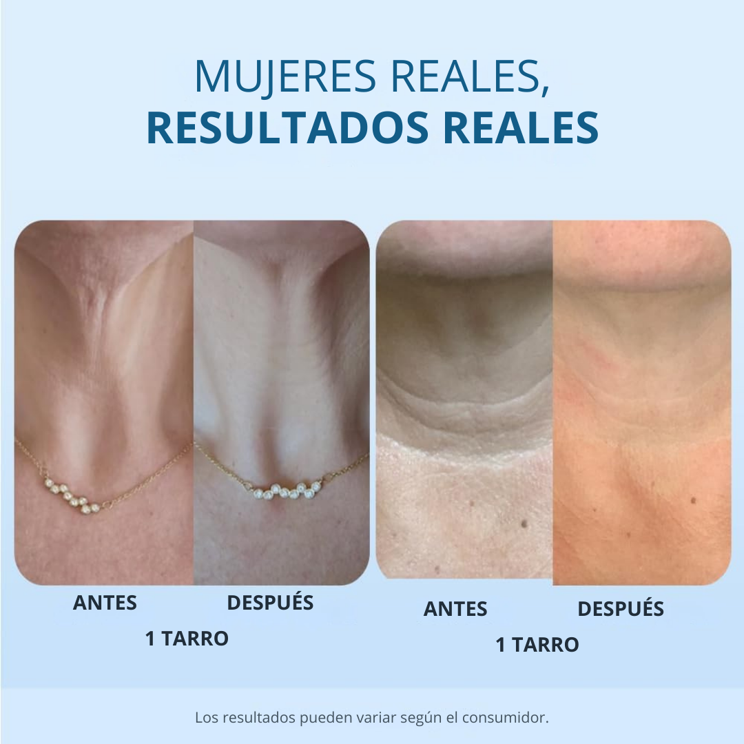 Crema reafirmante y tensora para el cuello para pieles con arrugas