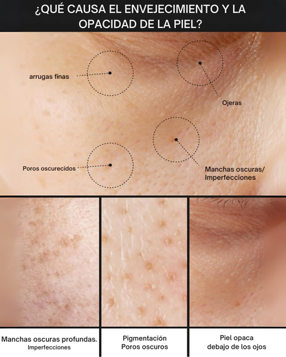 Crema anti-manchas Pore+ hidratante no irritante y reductora de poros (OFERTA 2X1)