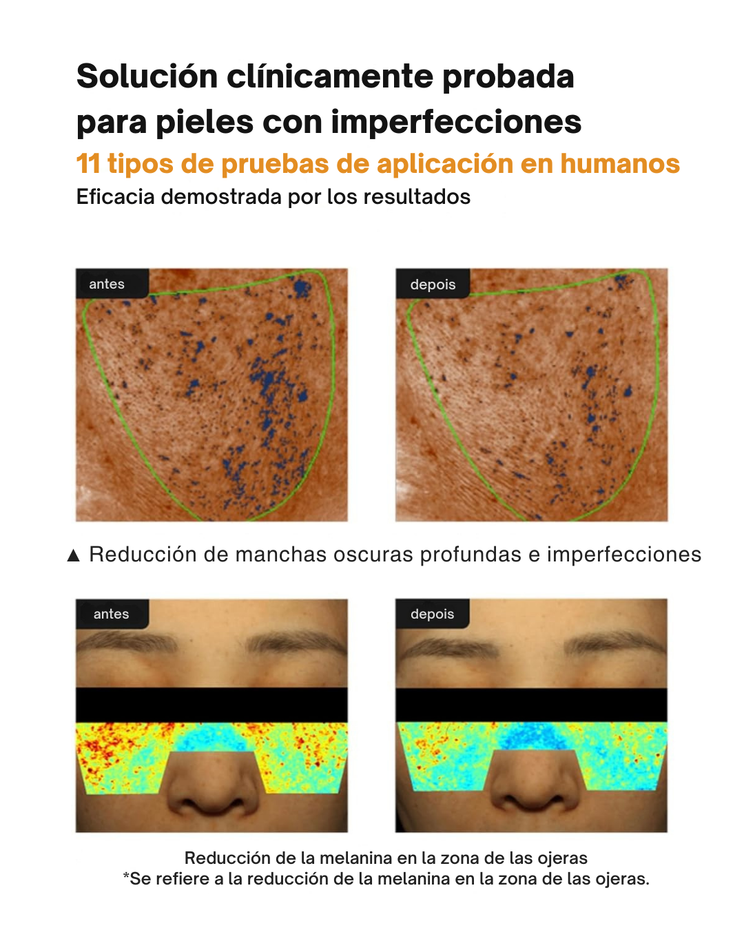 Crema anti-manchas Pore+ hidratante no irritante y reductora de poros (OFERTA 2X1)