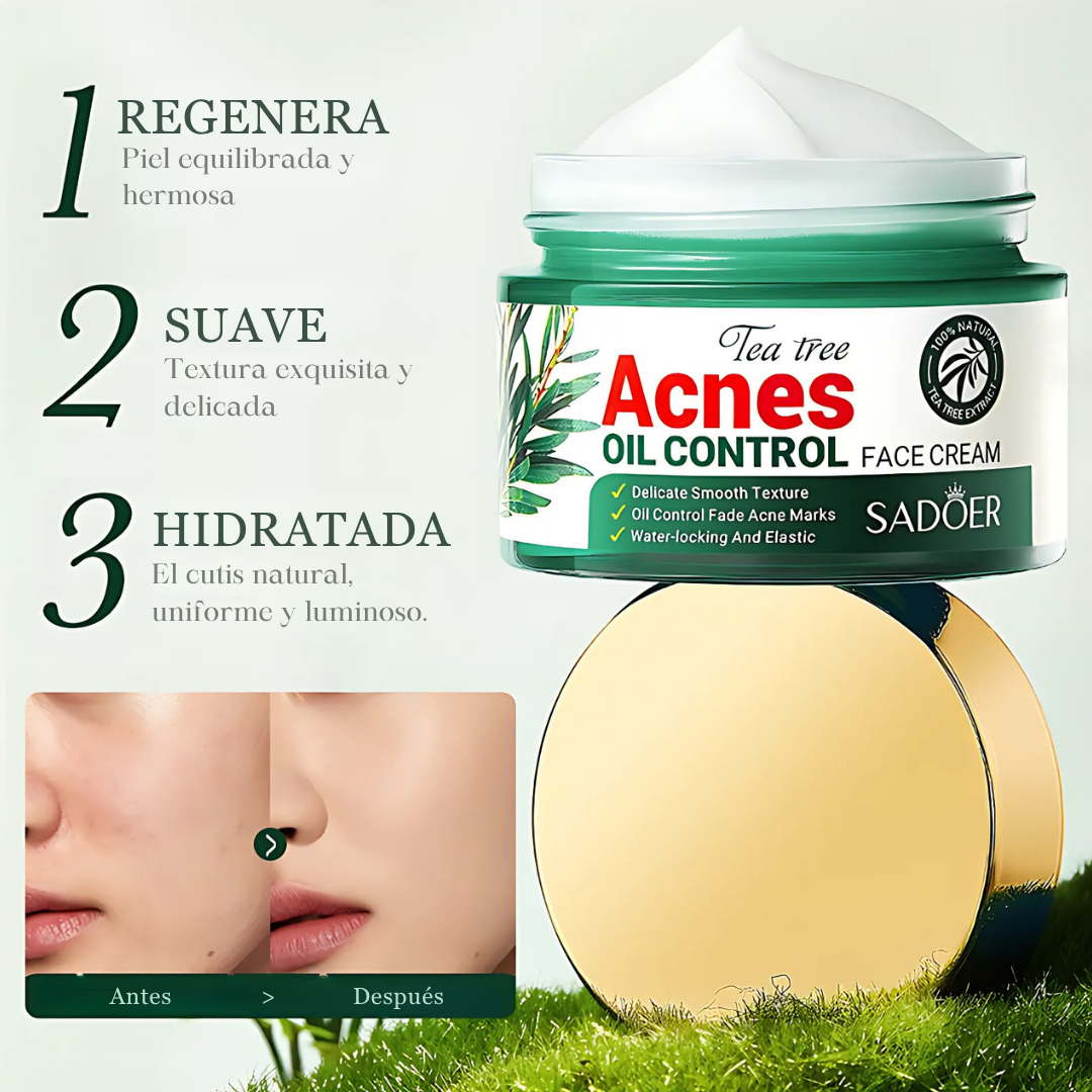 Crema Facial Antiacné con Aceite de Árbol de Té 50ml - SADOER (OFERTA 2x1)