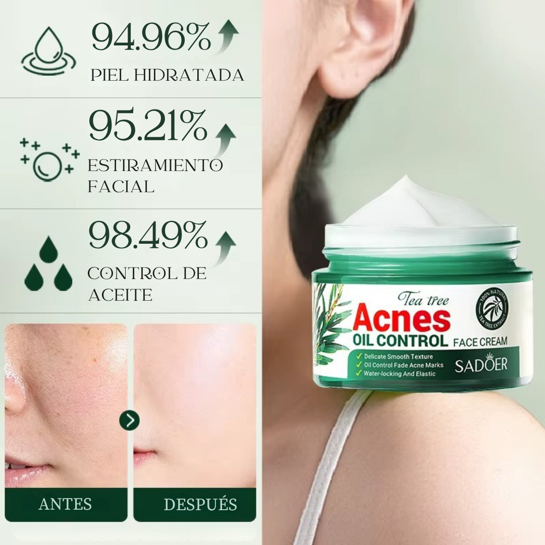 Crema Facial Antiacné con Aceite de Árbol de Té 50ml - SADOER (OFERTA 2x1)