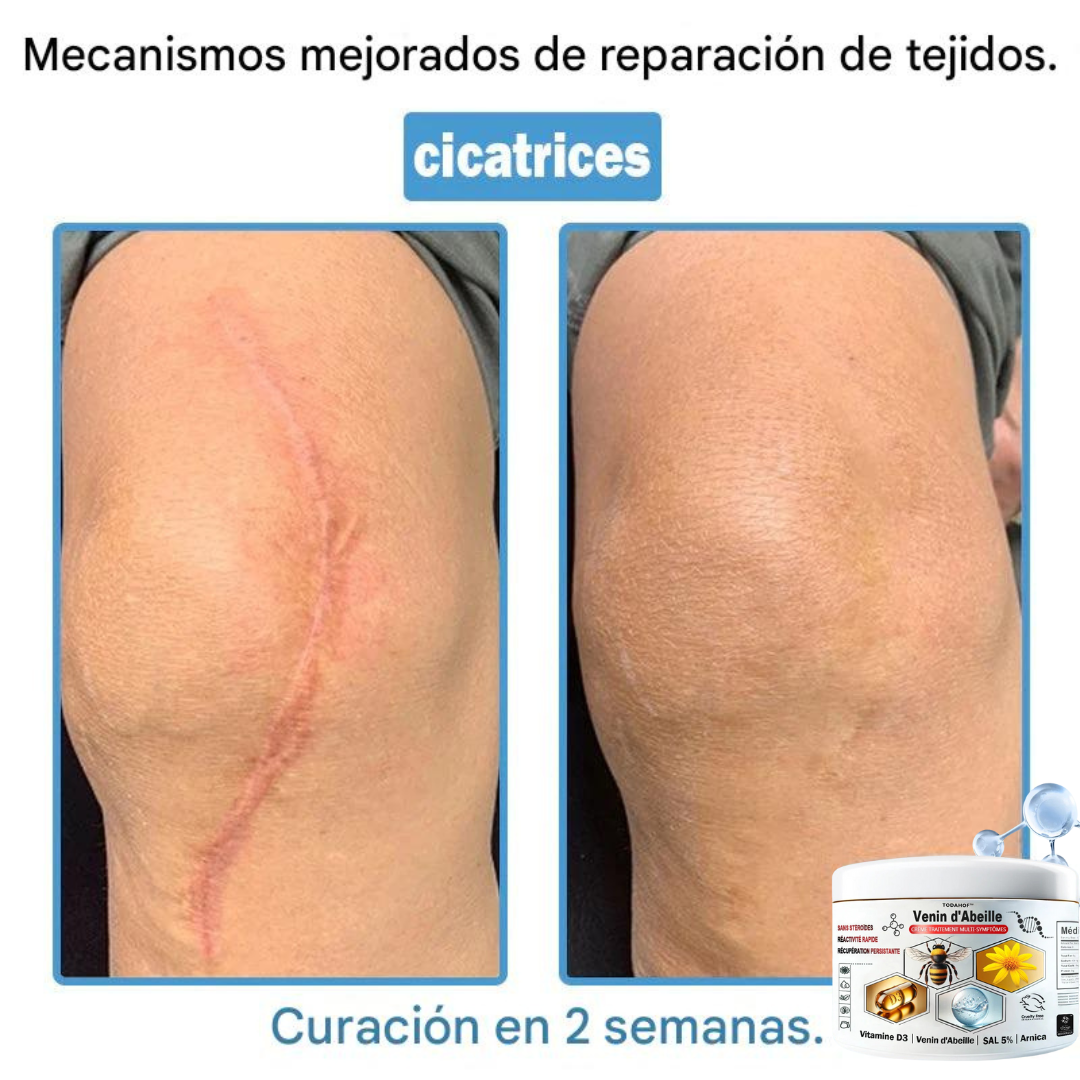 Crema antiinflamatoria multisíntomas con veneno de abeja (OFERTA 2X1)