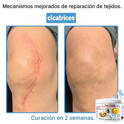 Crema antiinflamatoria multisíntomas con veneno de abeja (OFERTA 2X1)