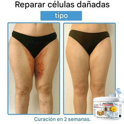 Crema antiinflamatoria multisíntomas con veneno de abeja (OFERTA 2X1)