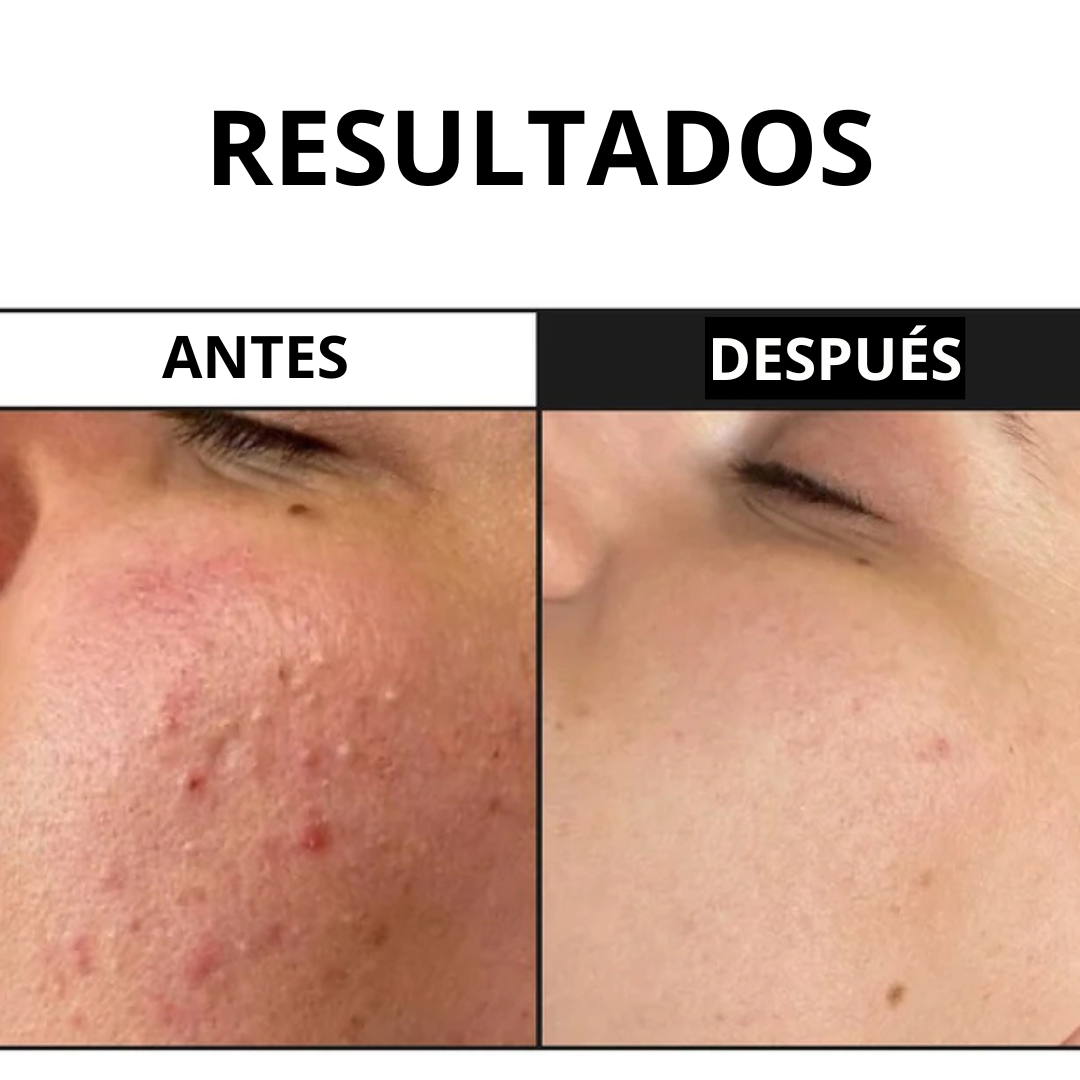 Serúm con 7 tipos de colágeno y espícula de diamante (OFERTA 2X1)