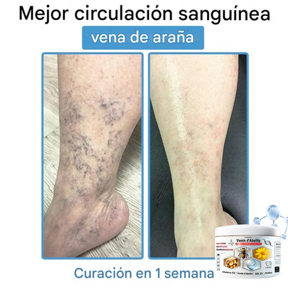 Crema antiinflamatoria multisíntomas con veneno de abeja (OFERTA 2X1)