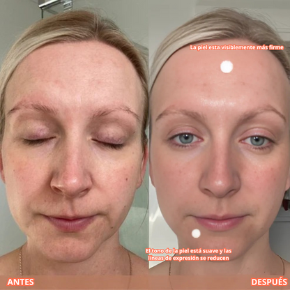 Serúm Antienvejecimiento con Péptidos de colágeno y Ácido hialurónico