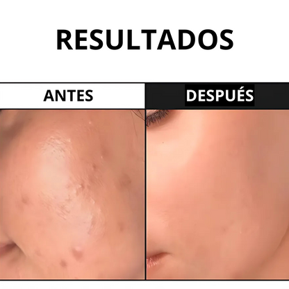 Serúm con 7 tipos de colágeno y espícula de diamante (OFERTA 2X1)