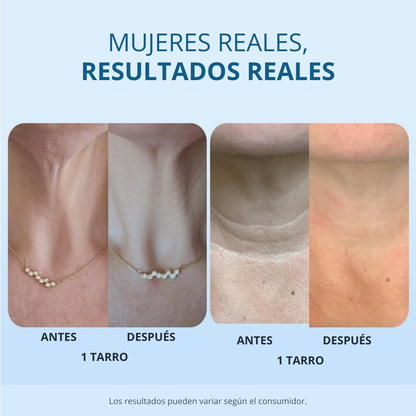 Crema reafirmante y tensora para el cuello para pieles con arrugas