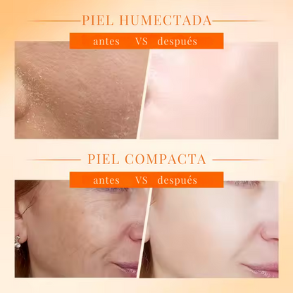 Crema facial blanqueadora 5 en 1 con Vitamina C activa + Niacinamida de 50ml - SADOER (OFERTA 2x1)
