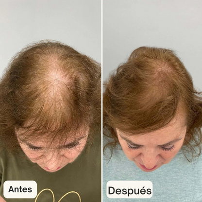 Suero anticaída para el cabello - HAIR BIOLABS 60 ml (OFERTA 2X1)