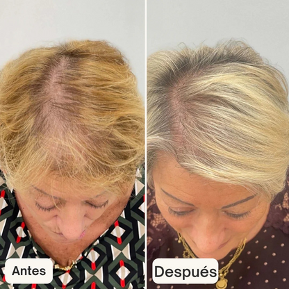 Suero anticaída para el cabello - HAIR BIOLABS 60 ml (OFERTA 2X1)